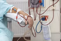 Lọc máu có hết được mỡ máu, phòng tiểu đường, đột quỵ...?