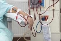 Lọc máu có hết được mỡ máu, phòng tiểu đường, đột quỵ...?