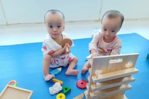 Ca tách dính Song Nhi hai tháng tới sẽ đứng vững và tập đi!