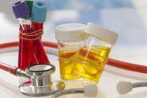 Xử lý khi có máu trong nước tiểu