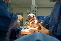 Thích sinh mổ cho an toàn... nào ngờ