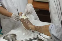 Tự dưng chân biến thành hình búa