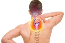 Bổ sung canxi khi bị gai cột sống