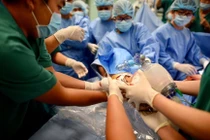 Khoảnh khắc tách rời hai bé song sinh dính liền