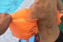  Giờ học bơi, thầy giáo phát hiện lưng học trò đầy vết thương