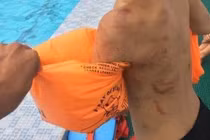  Giờ học bơi, thầy giáo phát hiện lưng học trò đầy vết thương