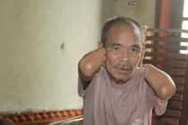 Cụt tay vì… cá