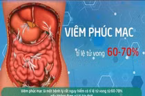 60 – 70% viêm phúc mạc ruột thừa tử vong