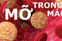 Thiếu ngủ gây tăng huyết áp