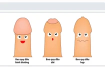 Tránh lạm dụng cắt bao quy đầu ở trẻ em