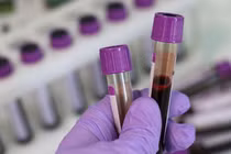 43% dân số Mỹ đã nhiễm virus SARS-CoV-2