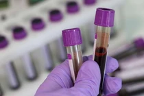 43% dân số Mỹ đã nhiễm virus SARS-CoV-2