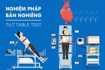 Nghiệm pháp bàn nghiêng khi ngất