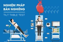 Nghiệm pháp bàn nghiêng khi ngất