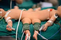 CLIP: Vừa tách rời hoàn toàn 2 bé song sinh Trúc Nhi - Diệu Nhi