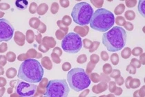 Cung cấp thuốc trực tiếp đến tế bào B để cải thiện phản ứng kháng thể