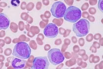 Cung cấp thuốc trực tiếp đến tế bào B để cải thiện phản ứng kháng thể