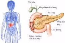Sinh thiết trong khi mổ