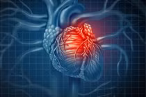 Xóa protein để ngăn ngừa cơn đau tim và đột quỵ