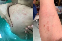 Dân chung cư TP.HCM bất an vì nước vàng khè, có bọ