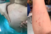 Dân chung cư TP.HCM bất an vì nước vàng khè, có bọ