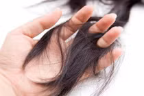 Làm gì khi bị rụng tóc do Covid-19?