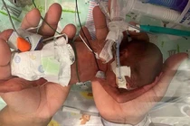 Chào đời chỉ 21 tuần tuổi, cậu bé phá kỷ lục sinh non nhất thế giới