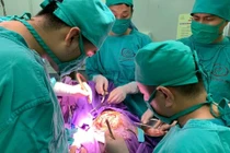 Chấn thương sọ não vì ngã đập đầu 