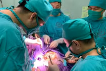 Chấn thương sọ não vì ngã đập đầu 