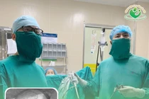 Mang thai trên vết sẹo mổ cũ