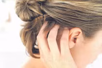 Trị nấm da đầu từ thảo dược