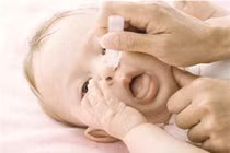 Dùng nhiều thuốc nhỏ mũi lợi ít, hại nhiều