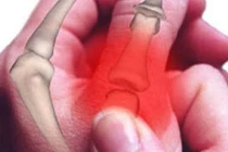 Dấu hiệu của ung thư xương