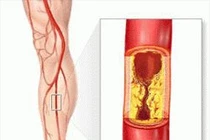 Tự nhiên chân trắng nhợt và tê cứng