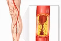 Tự nhiên chân trắng nhợt và tê cứng