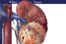 U nguyên bào thận ở trẻ