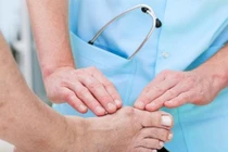 Những dấu hiệu nhận biết bệnh gút ở khớp ngón chân cái