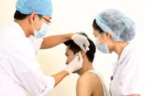 Cấy chỉ huyệt vị chữa nhiều bệnh lý