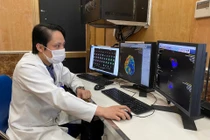 Cứu bệnh nhân nhồi máu bằng công nghệ trí tuệ nhân tạo RAPID 4.0