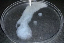  Nhìn tinh dịch chẩn đoán tinh trùng yếu, khỏe