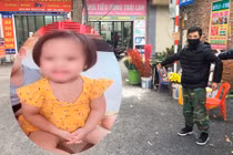 Khó tiên lượng về sức khỏe bé gái bị đóng đinh vào đầu