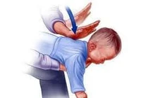 Sặc bột do viêm phổi chưa khỏi