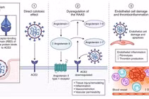 Biểu hiện ngoài phổi do virus SARS-CoV-2 gây ra