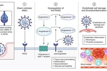 Biểu hiện ngoài phổi do virus SARS-CoV-2 gây ra