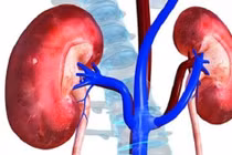 Suy thận độ 1 và những điều bạn cần biết để kiểm soát bệnh hiệu quả