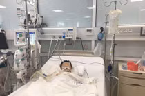 Trẻ hôn mê do ngộ độc paracetamol