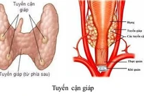Suy tuyến cận giáp
