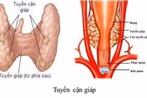Suy tuyến cận giáp