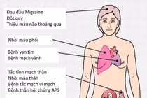 Cẩn thận với hội chứng kháng phospholipid nguy hiểm