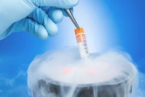 Nhiều người chọn đông lạnh trứng chờ sinh con sau tác động của đại dịch Covid